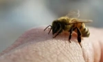 Apitherapy nebo léčba kousnutí včel