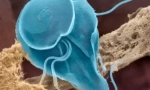 Jak projít lidi do giardia