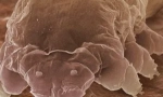 Mite demodex a rysy jeho živobytí