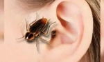 Tracakan v uchu: symptomy a extrakce