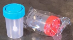 Analýza vajec na vejce