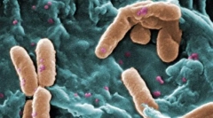 Jaké eukaryotes se liší od prokaryotu?