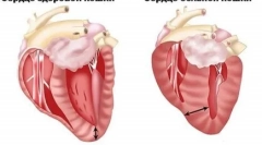 Co je hypertrofická kardiomyopatie u koček a co je nebezpečné