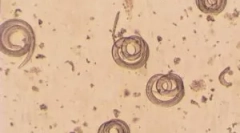 Co je trichinella spiralis