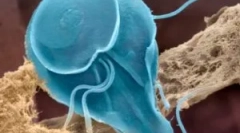 Jak projít lidi do giardia