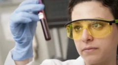Jak se krevní test provádí na toxoplazmóze