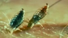 Jak vypadají vši, jak vypadají?