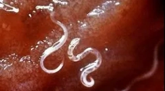 Jak malárie plazmodium žije a vyvíjí