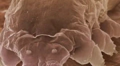 Mite demodex a rysy jeho živobytí