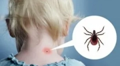 Reakce těla a klíště kousnutí