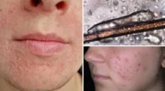 Analýza dodávky na demodecóze