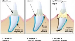 Péče o domácí predátor - cattick čištění