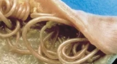 Vnitřní parazity (endoparasity)